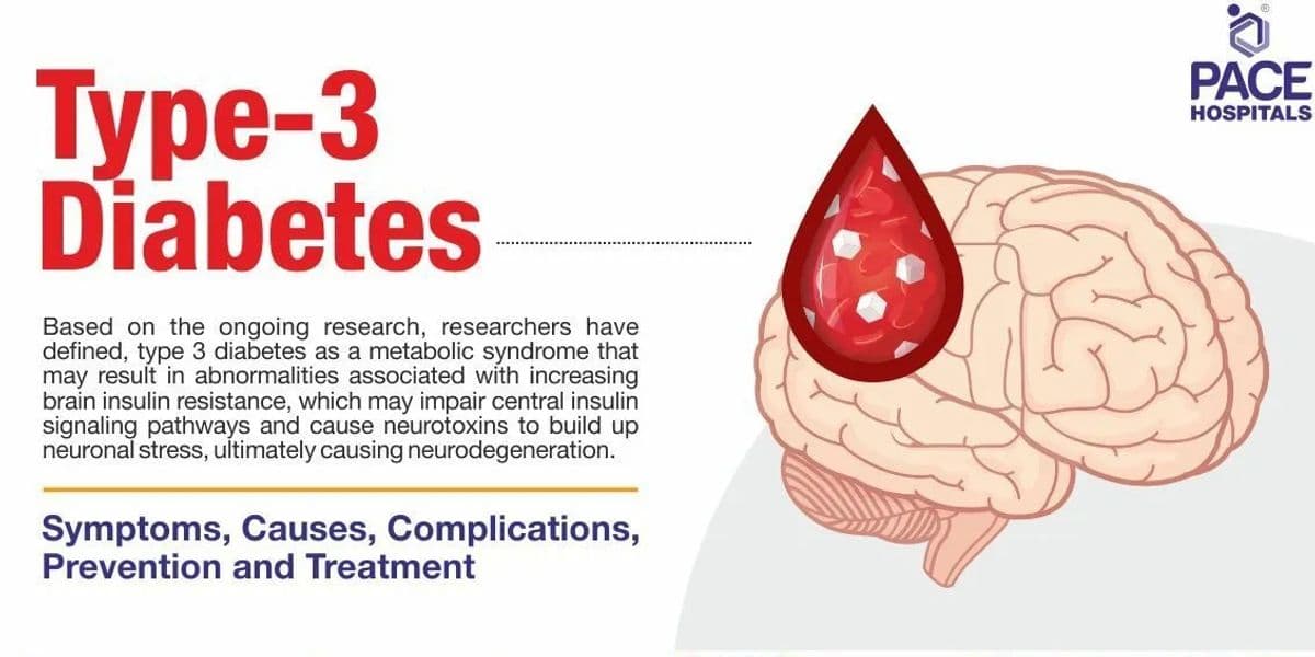 Diagram explaining Type 3 diabetes and its link to Alzheimer's disease